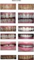 /album/cosmetic-dentistry/cosmatic-dental-2-jpg/